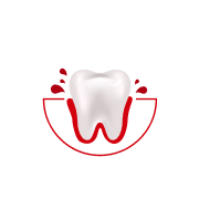 Jak często krwawią Ci dziąsła podczas szczotkowania lub nitkowania zębów?