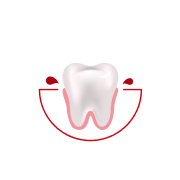 Jak często krwawią Ci dziąsła podczas szczotkowania lub nitkowania zębów?