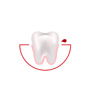 Jak często krwawią Ci dziąsła podczas szczotkowania lub nitkowania zębów?