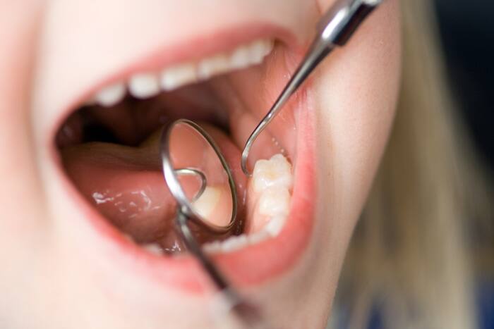 Dentysta sprawdzający zęby dziecka Dentysta sprawdzający zęby dziecka